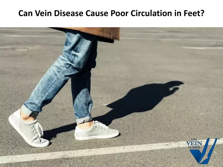 can vein disease cause poor circulation in feet