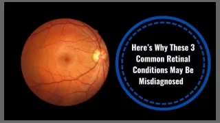 Here’s Why These 3 Common Retinal Conditions May Be Misdiagnosed