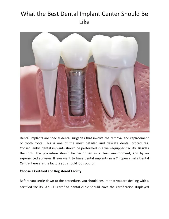 what the best dental implant center should be like