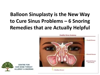 Balloon Sinuplasty is the New Way to Cure Sinus Problems – 6 Snoring Remedies that are Actually Helpful
