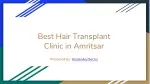 Best Hair Transplant Clinic in Amritsar