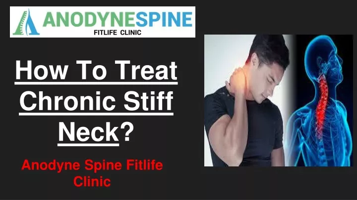 how to treat chronic stiff neck