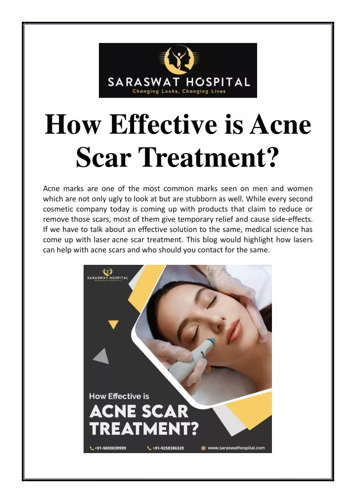 how effective is acne scar treatment acne marks