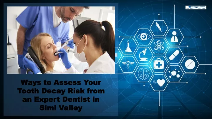 ways to assess your tooth decay risk from