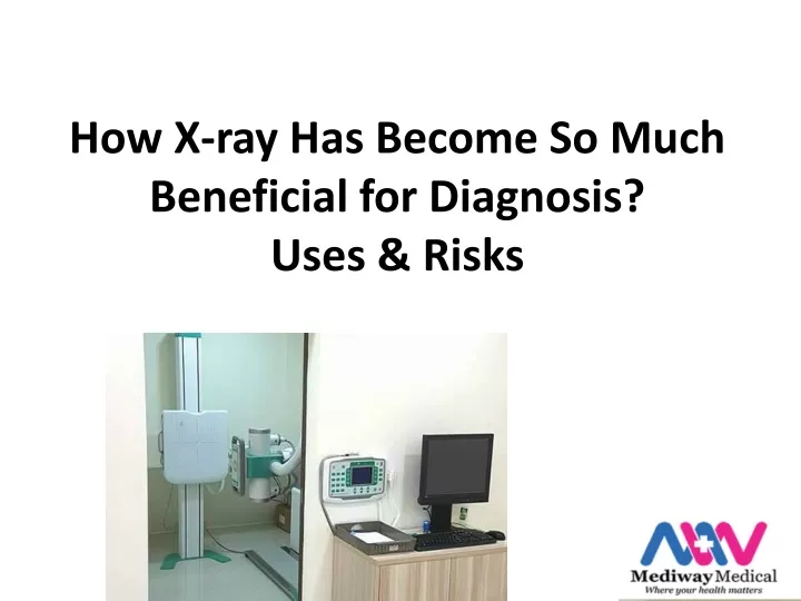 how x ray has become so much beneficial for diagnosis uses risks