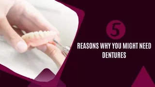 5 Reasons Why You Might Need Dentures