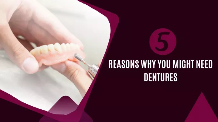 reasons why you might need dentures