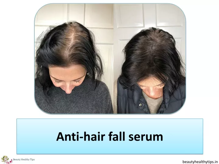 anti hair fall serum