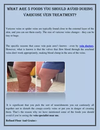 What Are 5 Foods You Should Avoid During Varicose Vein Treatment?