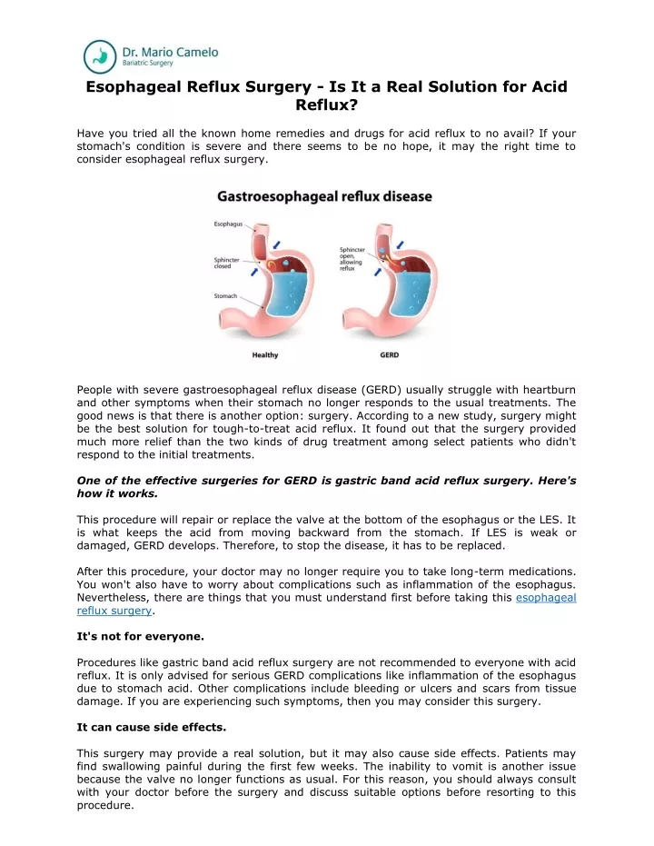 esophageal reflux surgery is it a real solution