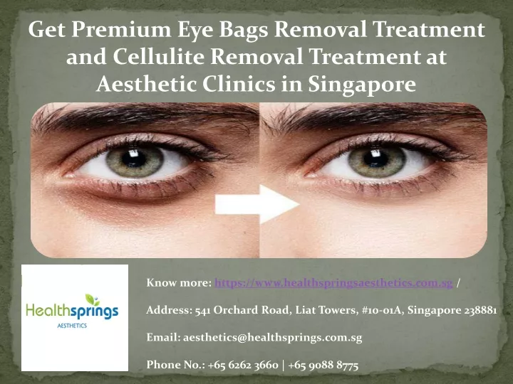 get premium eye bags removal treatment
