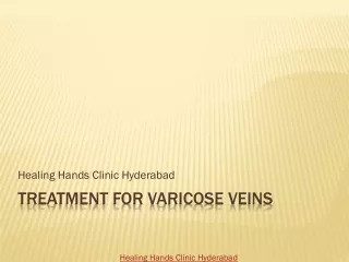 treatment for varicose veins