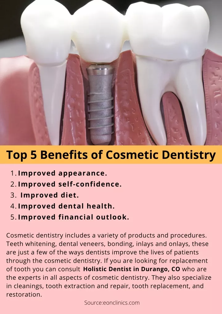 top 5 benefits of cosmetic dentistry