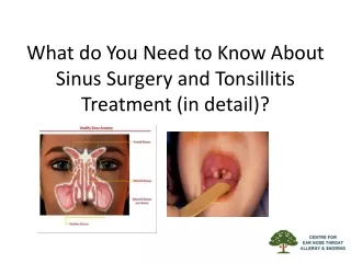 What do You Need to Know About Sinus Surgery and Tonsillitis Treatment (in detail)?