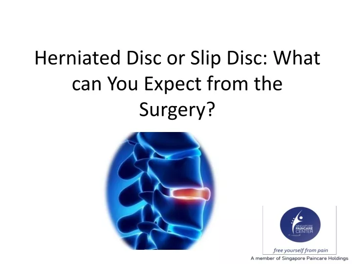 herniated disc or slip disc what can you expect from the surgery