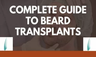 Complete Guide To Beard Transplants