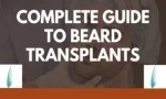 Complete Guide To Beard Transplants - slide 1