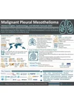 Malignant Pleural Mesothelioma (MPM) Market - slide 1