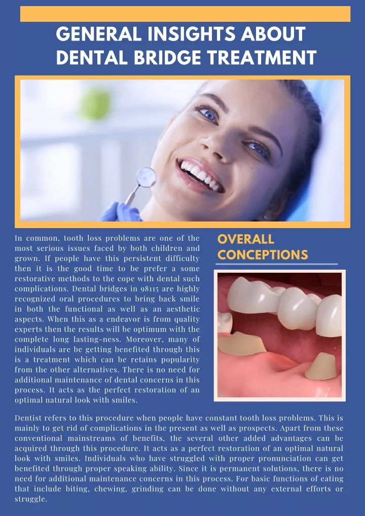 general insights about dental bridge treatment