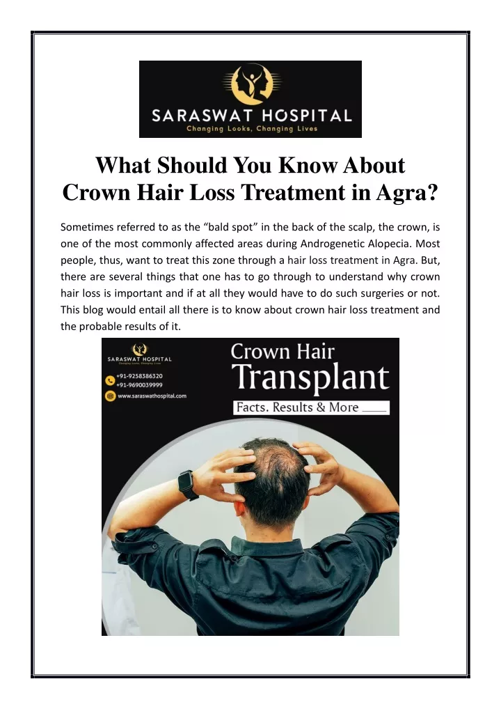 what should you know about crown hair loss