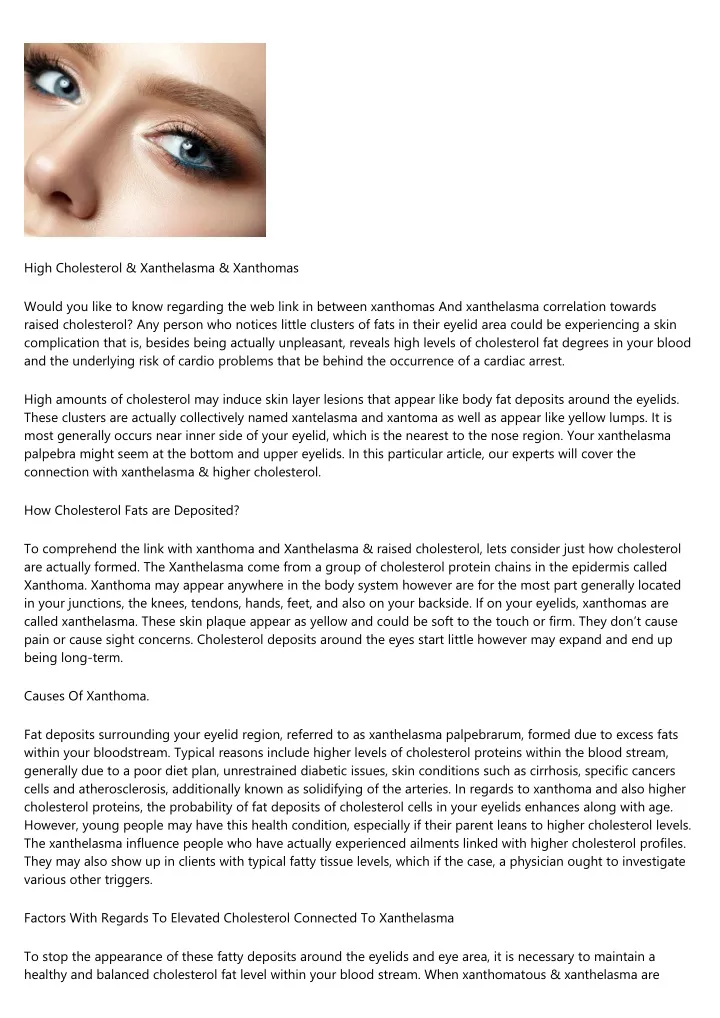 high cholesterol xanthelasma xanthomas