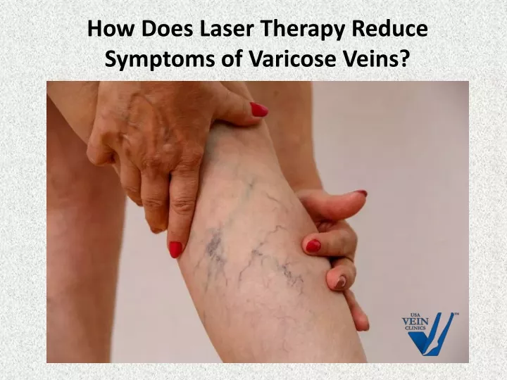how does laser therapy reduce symptoms of varicose veins