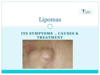 A Natural Solution for Lipoma Treatment