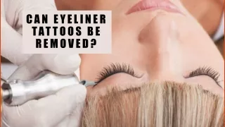 can eyeliner tattoos be removed