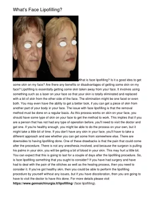 what s face lipofilling