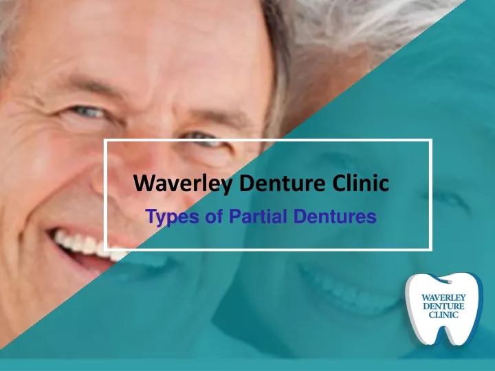 waverley denture clinic types of partial dentures