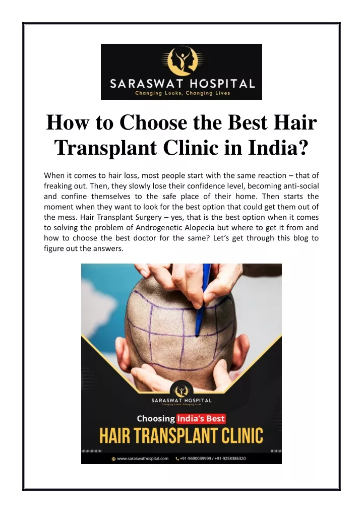 how to choose the best hair transplant clinic