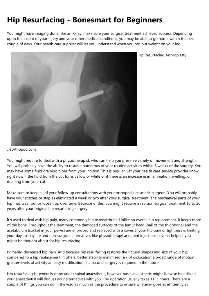 hip resurfacing bonesmart for beginners
