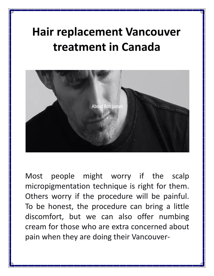 hair replacement vancouver treatment in canada