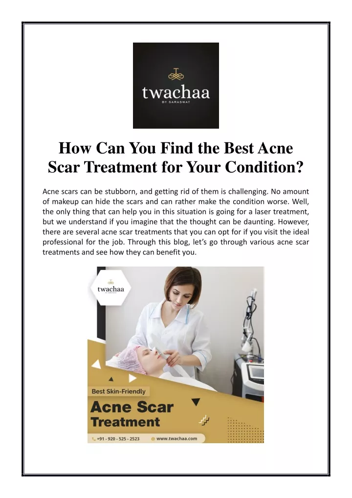 how can you find the best acne scar treatment