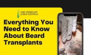 Everything You Need To Know About Beard Transplants