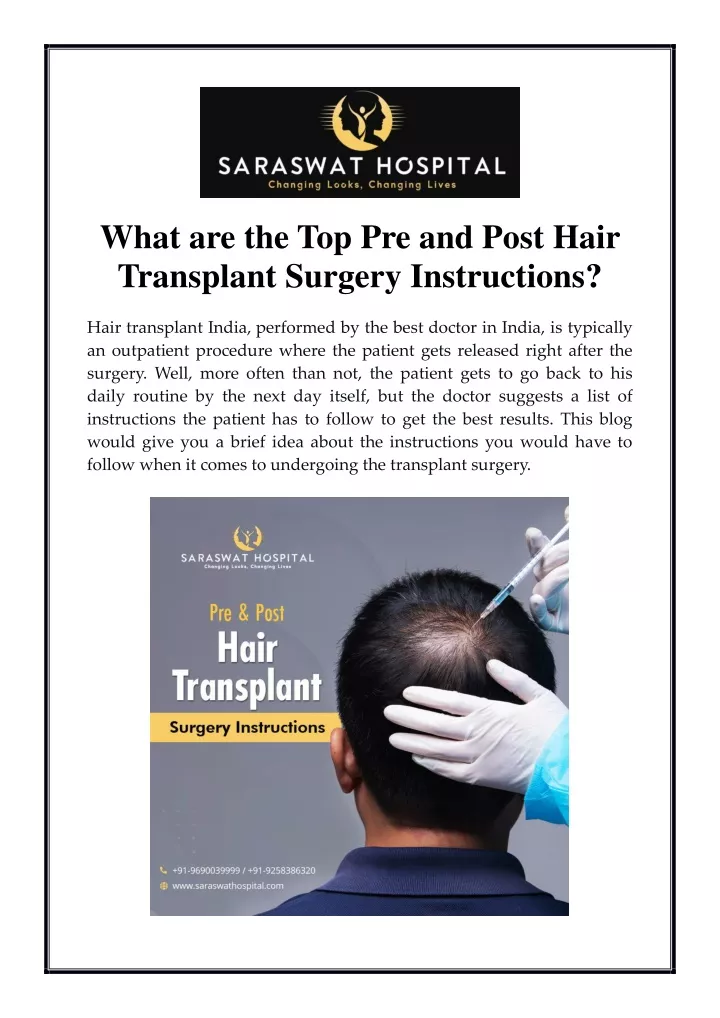 what are the top pre and post hair transplant