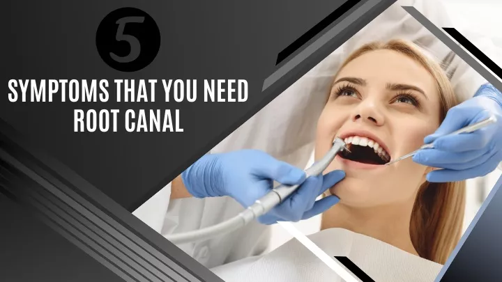 symptoms that you need root canal