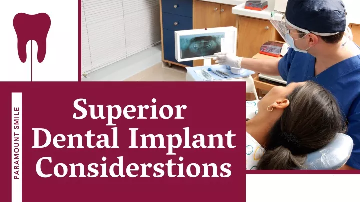superior dental implant considerstions