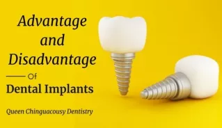 The Advantage and Disadvantage of Dental Implants