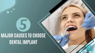 5 Major Causes to Choose Dental Implant