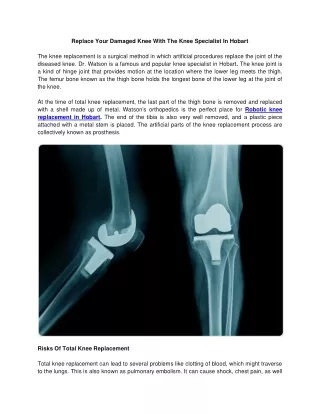 Replace Your Damaged Knee With The Knee Specialist In Hobart