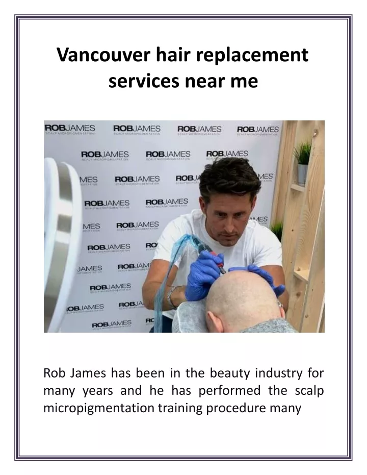 vancouver hair replacement services near me