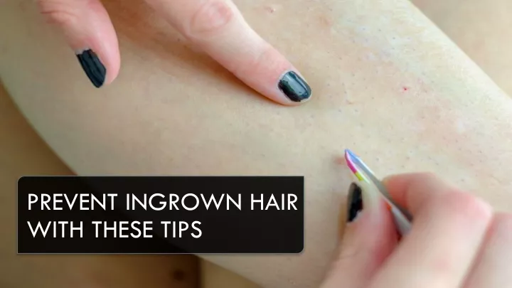 prevent ingrown hair with these tips