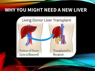 Find the best liver transplant in Mumbai