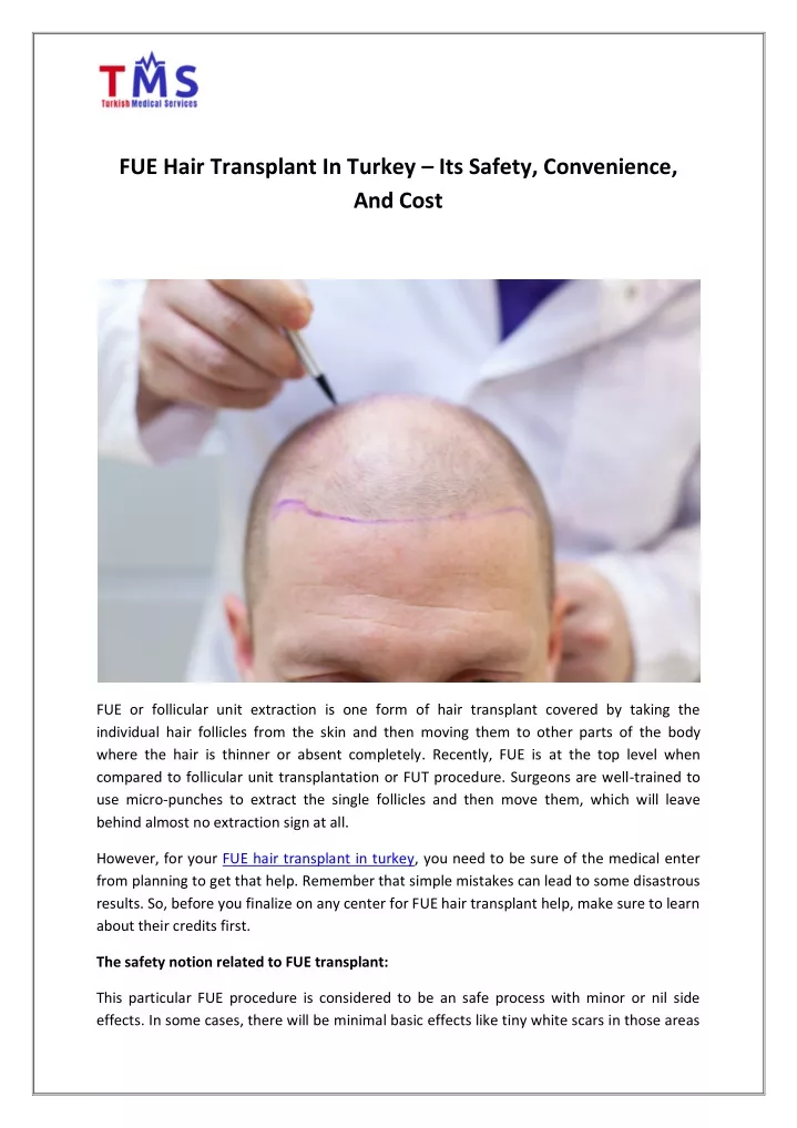 fue hair transplant in turkey its safety