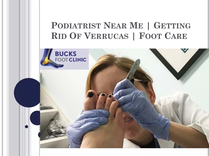 podiatrist near me getting rid of verrucas foot care