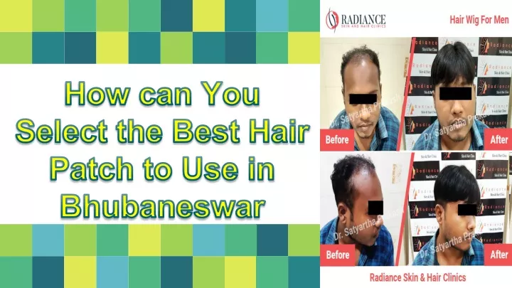 how can you select the best hair patch