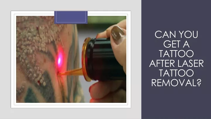 can you get a tattoo after laser tattoo removal