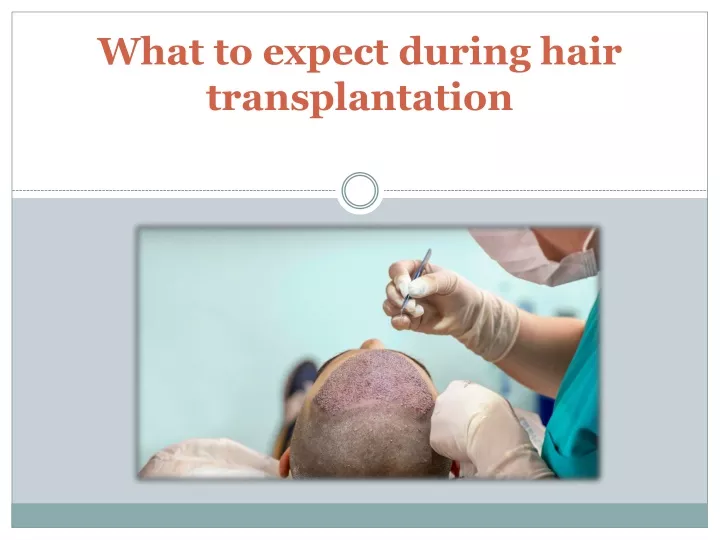 what to expect during hair transplantation