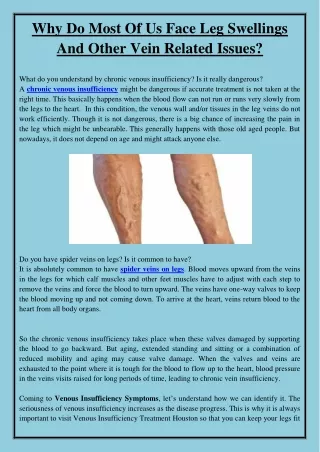 Why Do Most Of Us Face Leg Swellings And Other Vein Related Issues?
